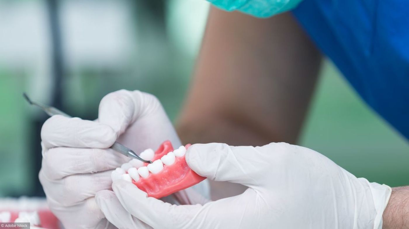 Implant dentaire : quel est son rôle ?